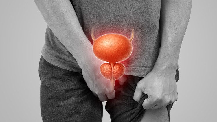 Prostate Cancer Treatment in India